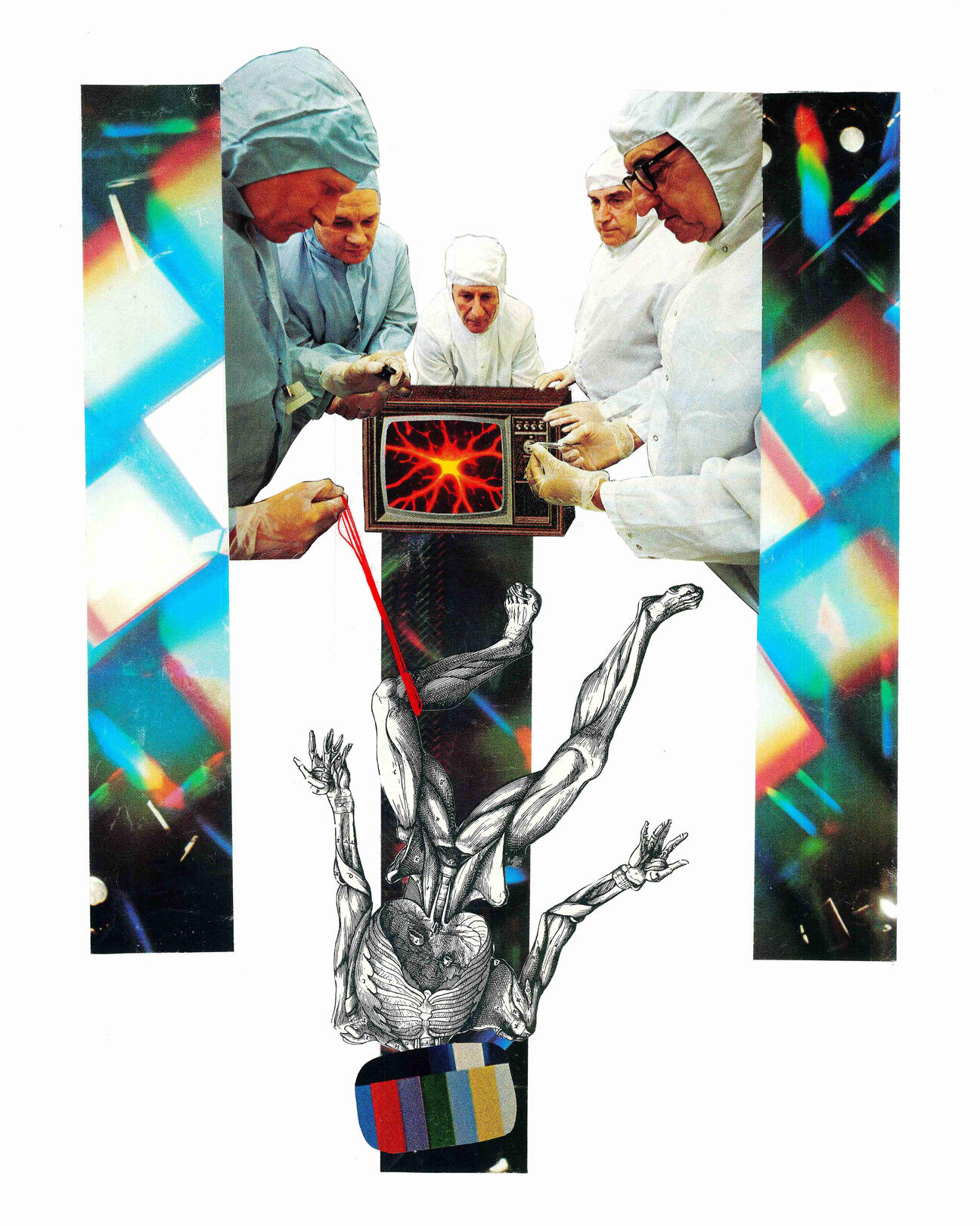 RETINAL DETACHMENT (2024)